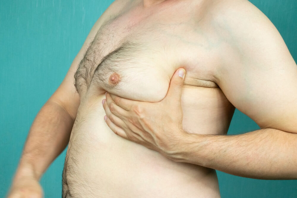 jinekomastiye kesin cozum